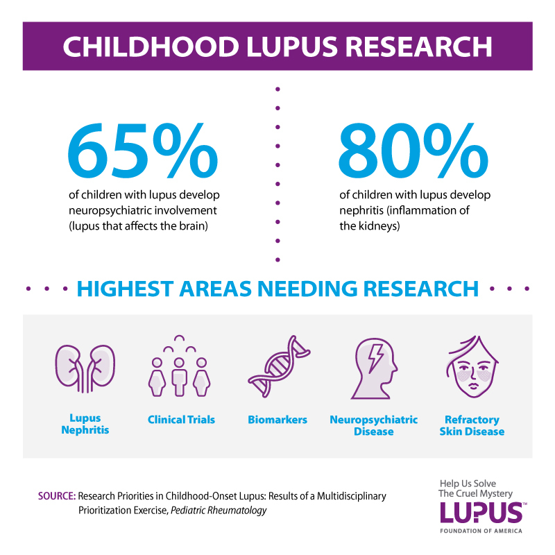 lupus research study